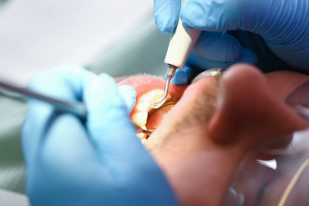 Best Cracked Tooth Emergency Dentist  in Indiana, PA